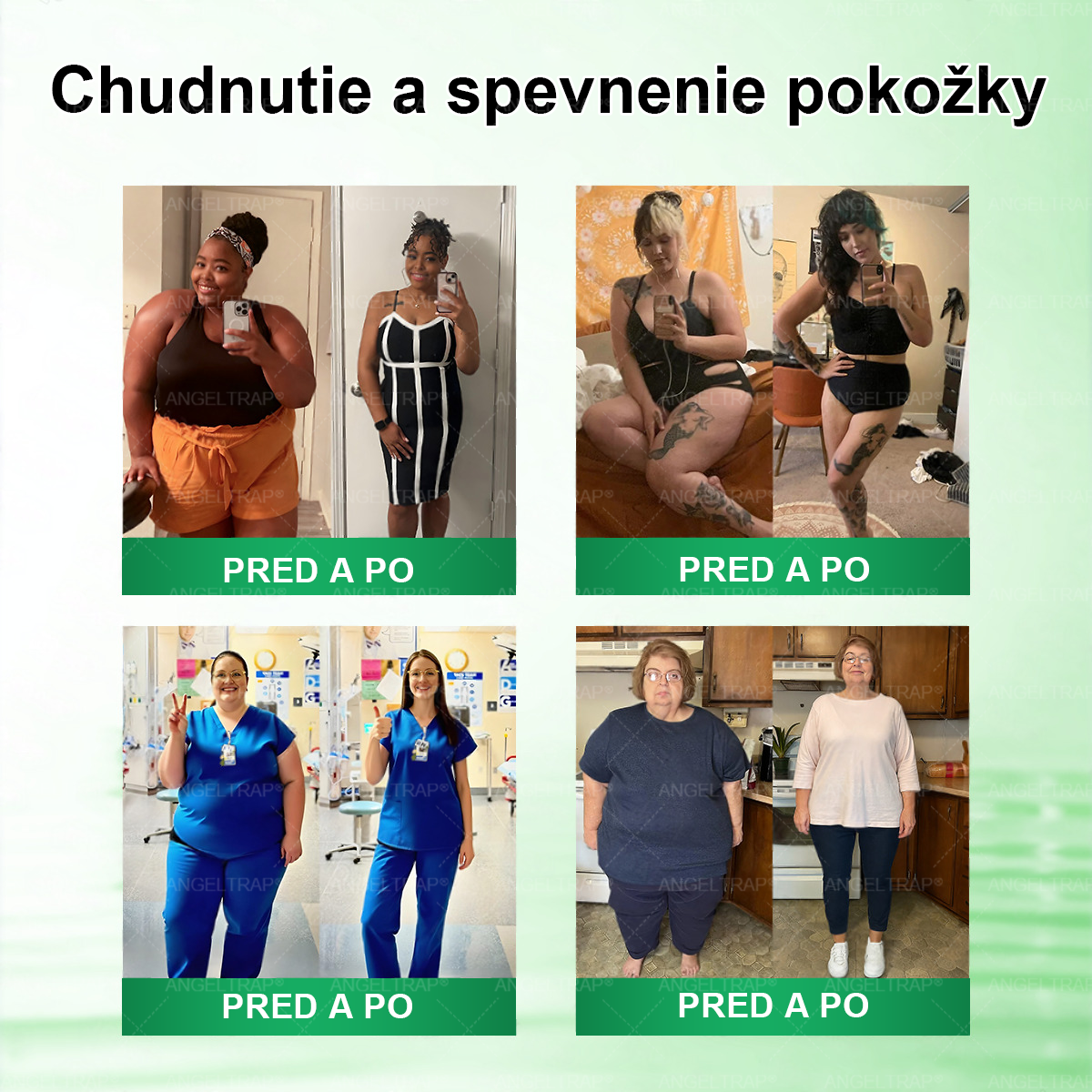 𝐴𝑁𝐺𝐸𝐿𝑇𝑅𝐴𝑃® Moringa × Berberine × AMPK 10-in-1 Metabolic Support Nano Microneedle Patch 🇸🇰 (Na použitie iba raz denne, viditeľné zmeny už po 7 dňoch) ✅ Podporuje chudnutie, metabolické zdravie, spánkovú apnoe, problémy s kĺbmi a mnoho ďalších výhod🔥⏰