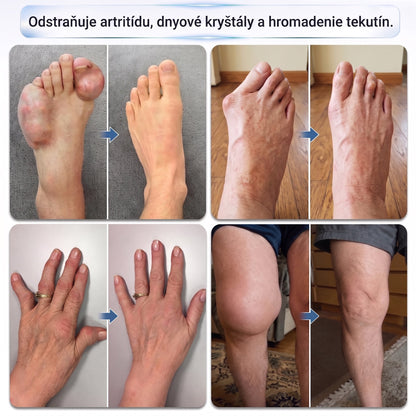 XRLXRL®🦵 ORTOPEDICKÁ REGENERAČNÁ TECHNOLÓGIA NOVEJ GENERÁCIE 0,05 mm mikroihličkový regeneračný valček na kosti a kĺby