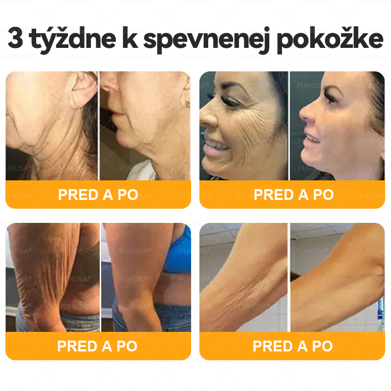𝐕𝐲𝐫𝐨𝐛𝐞𝐧é 𝐚 𝐨𝐝𝐨𝐬𝐥𝐚𝐧é 𝐳𝐨 𝐒𝐥𝐨𝐯𝐞𝐧𝐬𝐤𝐚 🌿🌿🌿 𝑷𝑼𝑹𝑶𝑺𝑨® 𝒗č𝒆𝒍í 𝒋𝒆𝒅 𝑲𝒓é𝒎 𝒏𝒂 𝒐𝒃𝒏𝒐𝒗𝒖 𝒑𝒐𝒌𝒐ž𝒌𝒚 🔥🔥 𝗣𝗢𝗦𝗟𝗘𝗗𝗡Ý 𝗗𝗘Ň 𝟴𝟬% 𝗭Ľ𝗔𝗩𝗔
