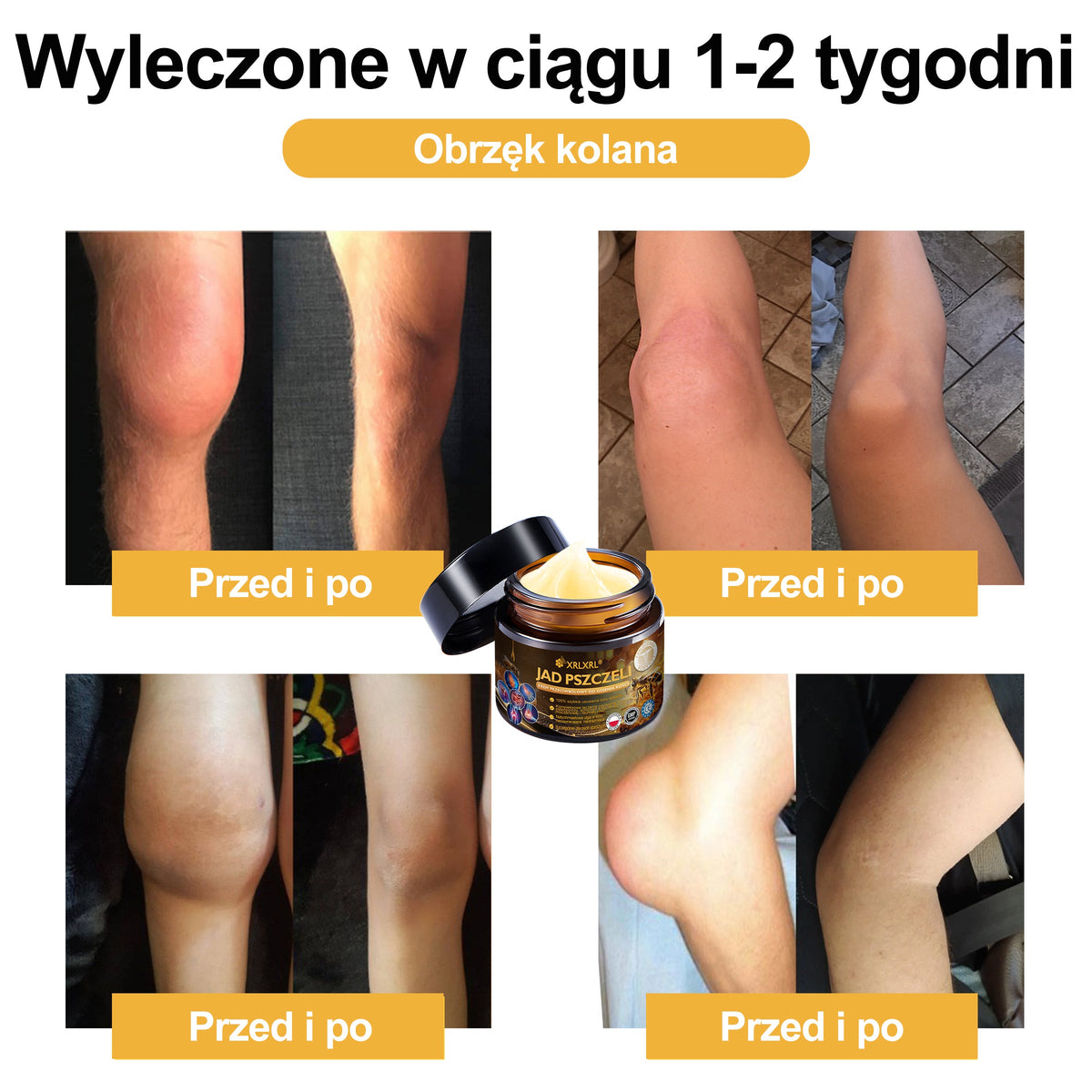 Oficiálny obchod: 🧑‍⚕️ XRLXRL® Okamžitý ultra silný krém proti bolesti s včelím jedom – (Uľavuje od bolesti pri artritíde, bolesti svalov, chrbta, kolien, chrbta, ramien, bedier, zápästí a rúk)