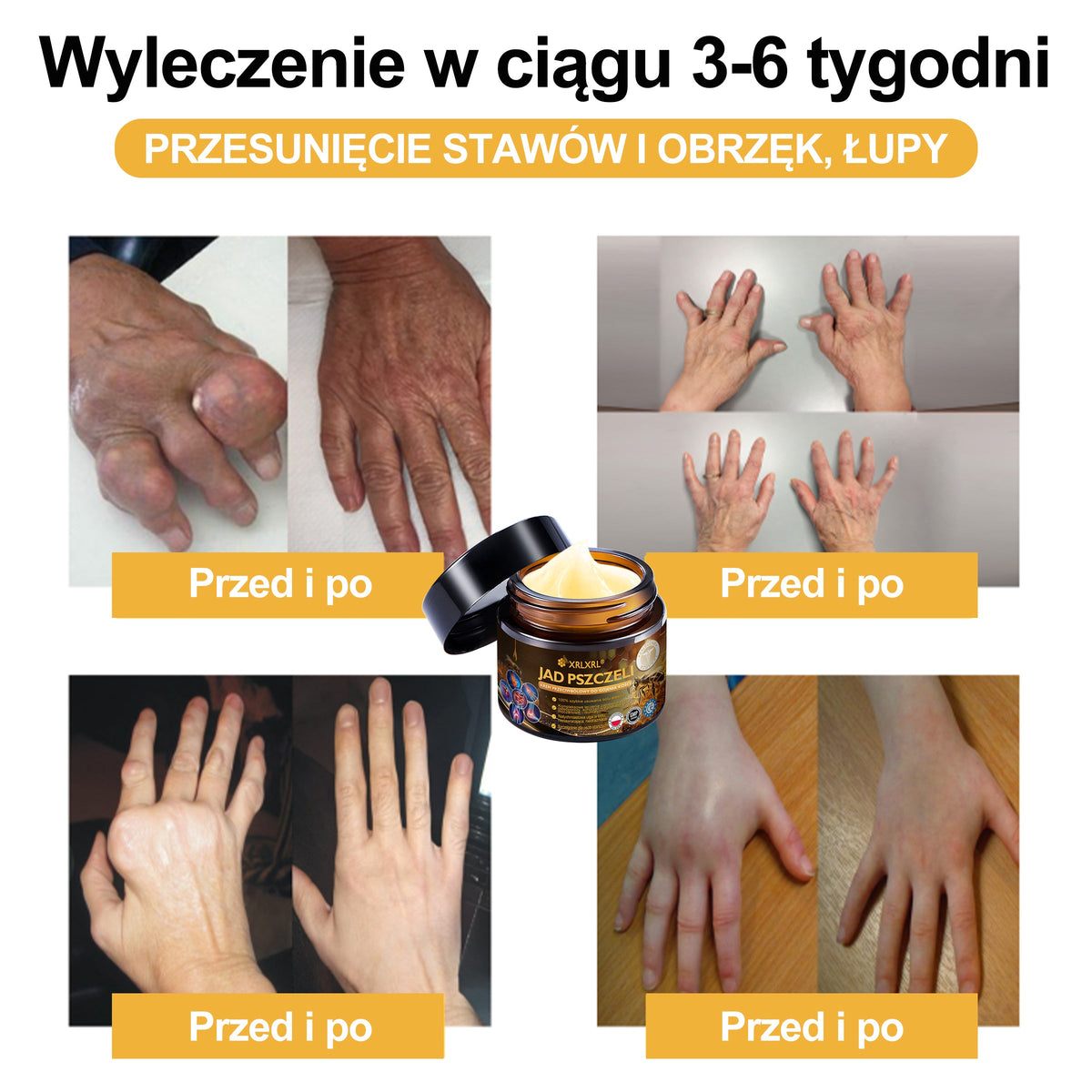 Oficiálny obchod: 🧑‍⚕️ XRLXRL® Okamžitý ultra silný krém proti bolesti s včelím jedom – (Uľavuje od bolesti pri artritíde, bolesti svalov, chrbta, kolien, chrbta, ramien, bedier, zápästí a rúk)
