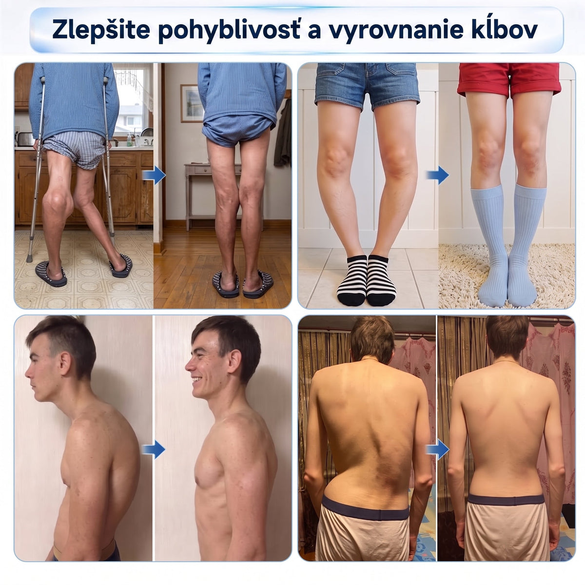 XRLXRL®🦵 ORTOPEDICKÁ REGENERAČNÁ TECHNOLÓGIA NOVEJ GENERÁCIE 0,05 mm mikroihličkový regeneračný valček na kosti a kĺby