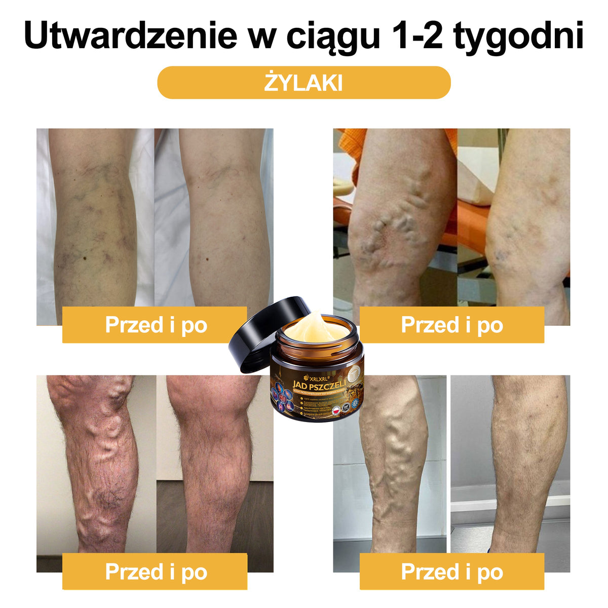 Oficiálny obchod: 🧑‍⚕️ XRLXRL® Okamžitý ultra silný krém proti bolesti s včelím jedom – (Uľavuje od bolesti pri artritíde, bolesti svalov, chrbta, kolien, chrbta, ramien, bedier, zápästí a rúk)