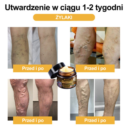 Oficiálny obchod: 🧑‍⚕️ XRLXRL® Okamžitý ultra silný krém proti bolesti s včelím jedom – (Uľavuje od bolesti pri artritíde, bolesti svalov, chrbta, kolien, chrbta, ramien, bedier, zápästí a rúk)