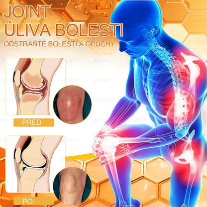 Oficiálny obchod: 🧑‍⚕️ XRLXRL® Okamžitý ultra silný krém proti bolesti s včelím jedom – (Uľavuje od bolesti pri artritíde, bolesti svalov, chrbta, kolien, chrbta, ramien, bedier, zápästí a rúk)