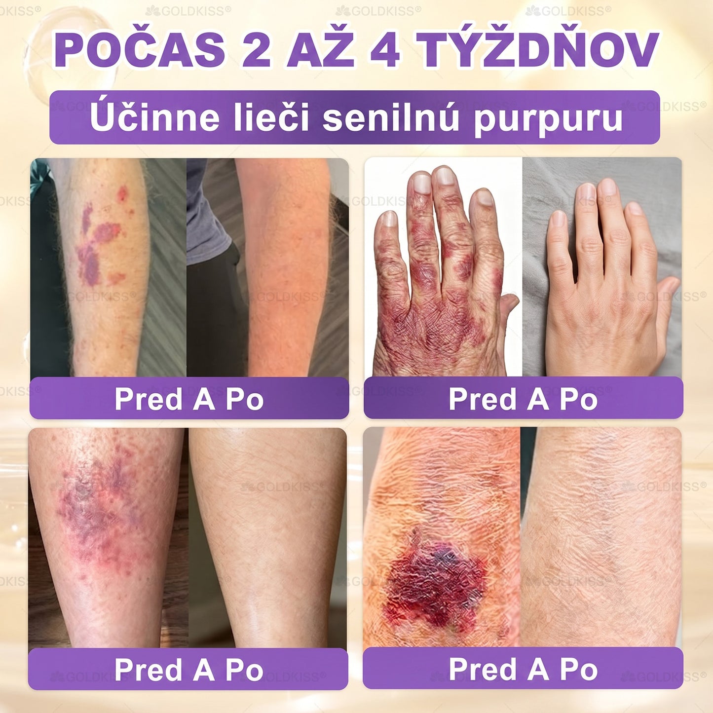 Vyrobené a odoslané zo Slovenska✨ 𝐆𝐎𝐋𝐃𝐊𝐈𝐒𝐒® 𝐆𝐇𝐊-𝐂𝐮 & 𝐁𝐈𝐎𝐓𝐈𝐍 𝟏𝟎-𝐈𝐍-𝟏 Krém na obnovenie pleti ⚡