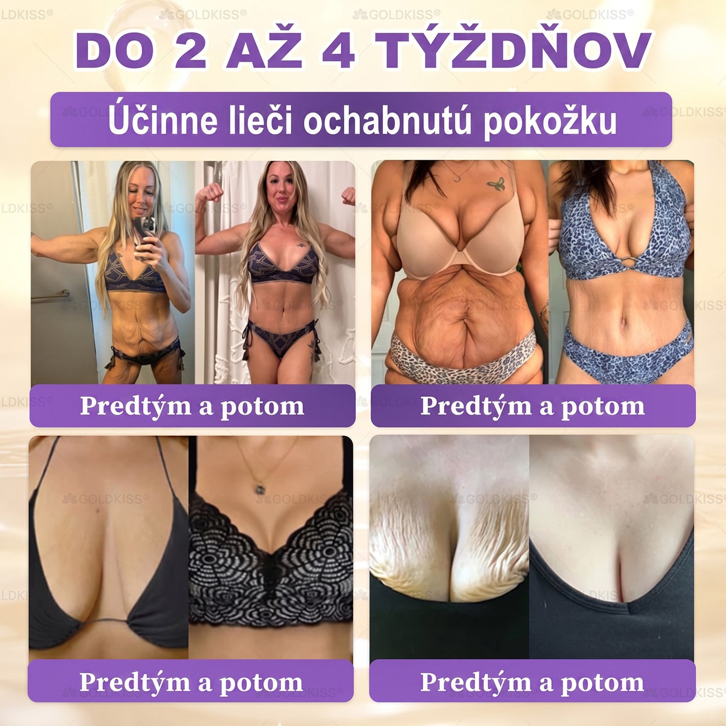 Vyrobené a odoslané zo Slovenska✨ 𝐆𝐎𝐋𝐃𝐊𝐈𝐒𝐒® 𝐆𝐇𝐊-𝐂𝐮 & 𝐁𝐈𝐎𝐓𝐈𝐍 𝟏𝟎-𝐈𝐍-𝟏 Krém na obnovenie pleti ⚡