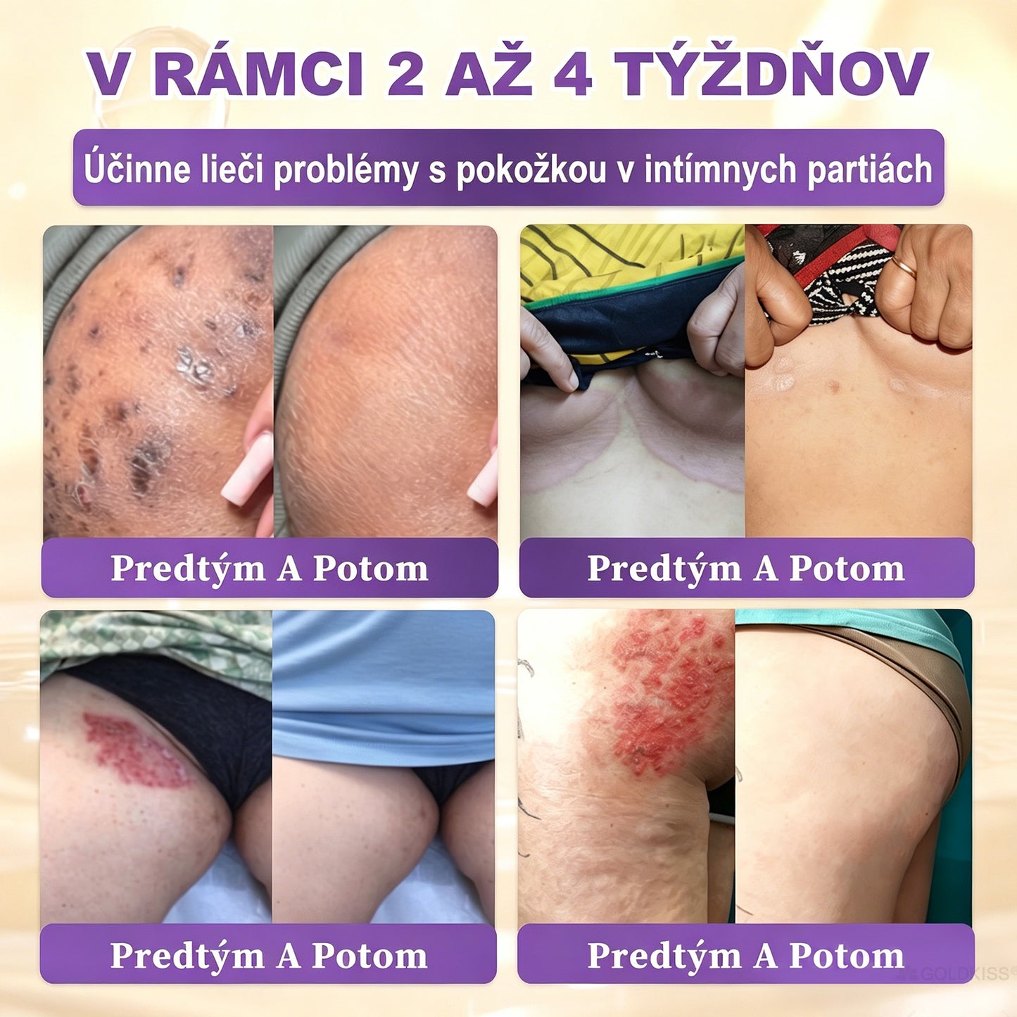 Vyrobené a odoslané zo Slovenska✨ 𝐆𝐎𝐋𝐃𝐊𝐈𝐒𝐒® 𝐆𝐇𝐊-𝐂𝐮 & 𝐁𝐈𝐎𝐓𝐈𝐍 𝟏𝟎-𝐈𝐍-𝟏 Krém na obnovenie pleti ⚡