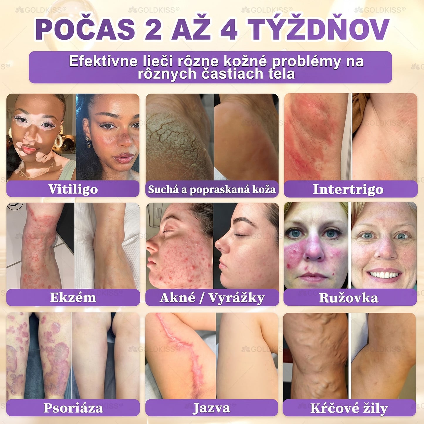 Vyrobené a odoslané zo Slovenska✨ 𝐆𝐎𝐋𝐃𝐊𝐈𝐒𝐒® 𝐆𝐇𝐊-𝐂𝐮 & 𝐁𝐈𝐎𝐓𝐈𝐍 𝟏𝟎-𝐈𝐍-𝟏 Krém na obnovenie pleti ⚡