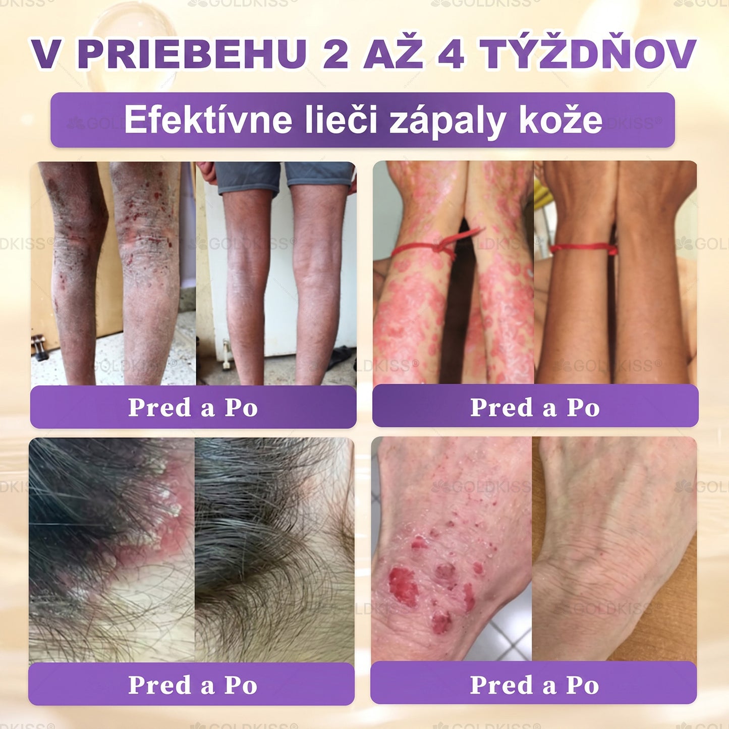 Vyrobené a odoslané zo Slovenska✨ 𝐆𝐎𝐋𝐃𝐊𝐈𝐒𝐒® 𝐆𝐇𝐊-𝐂𝐮 & 𝐁𝐈𝐎𝐓𝐈𝐍 𝟏𝟎-𝐈𝐍-𝟏 Krém na obnovenie pleti ⚡