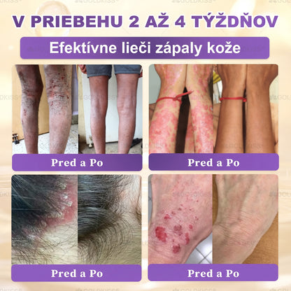 Vyrobené a odoslané zo Slovenska✨ 𝐆𝐎𝐋𝐃𝐊𝐈𝐒𝐒® 𝐆𝐇𝐊-𝐂𝐮 & 𝐁𝐈𝐎𝐓𝐈𝐍 𝟏𝟎-𝐈𝐍-𝟏 Krém na obnovenie pleti ⚡