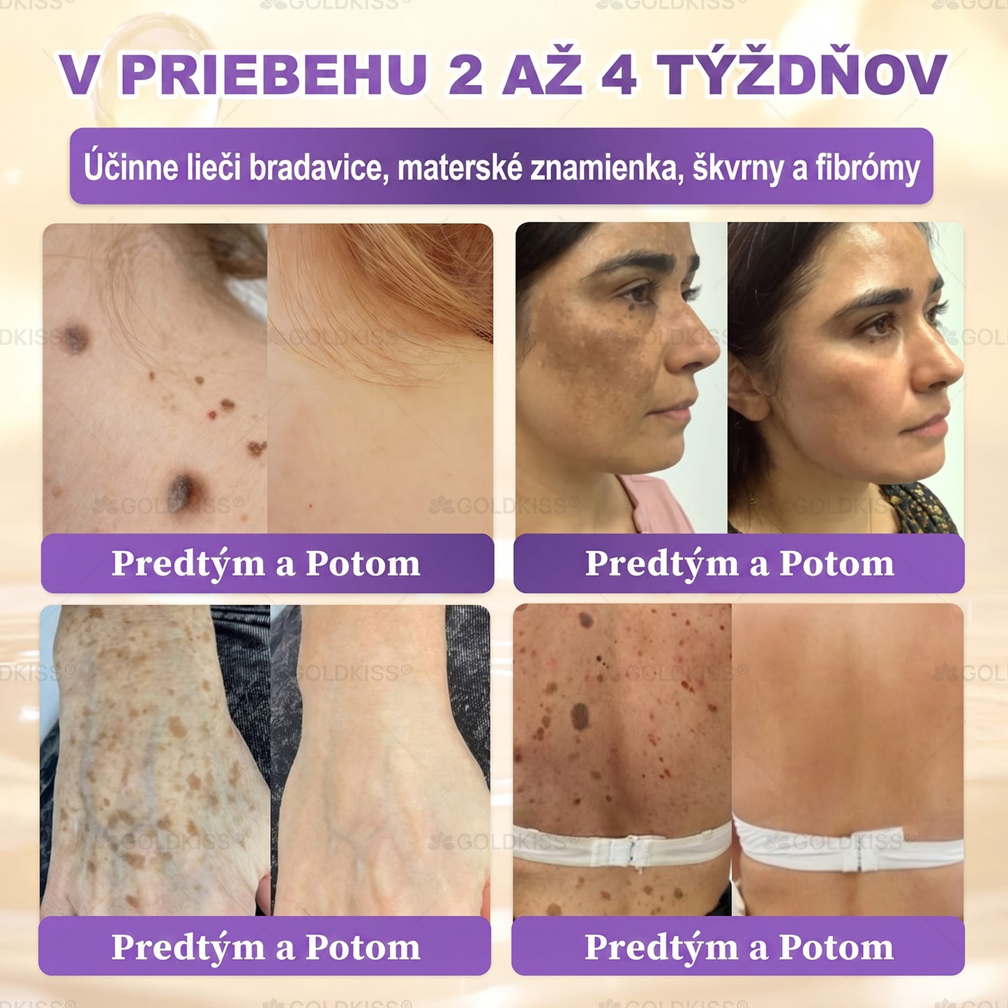 Vyrobené a odoslané zo Slovenska✨ 𝐆𝐎𝐋𝐃𝐊𝐈𝐒𝐒® 𝐆𝐇𝐊-𝐂𝐮 & 𝐁𝐈𝐎𝐓𝐈𝐍 𝟏𝟎-𝐈𝐍-𝟏 Krém na obnovenie pleti ⚡