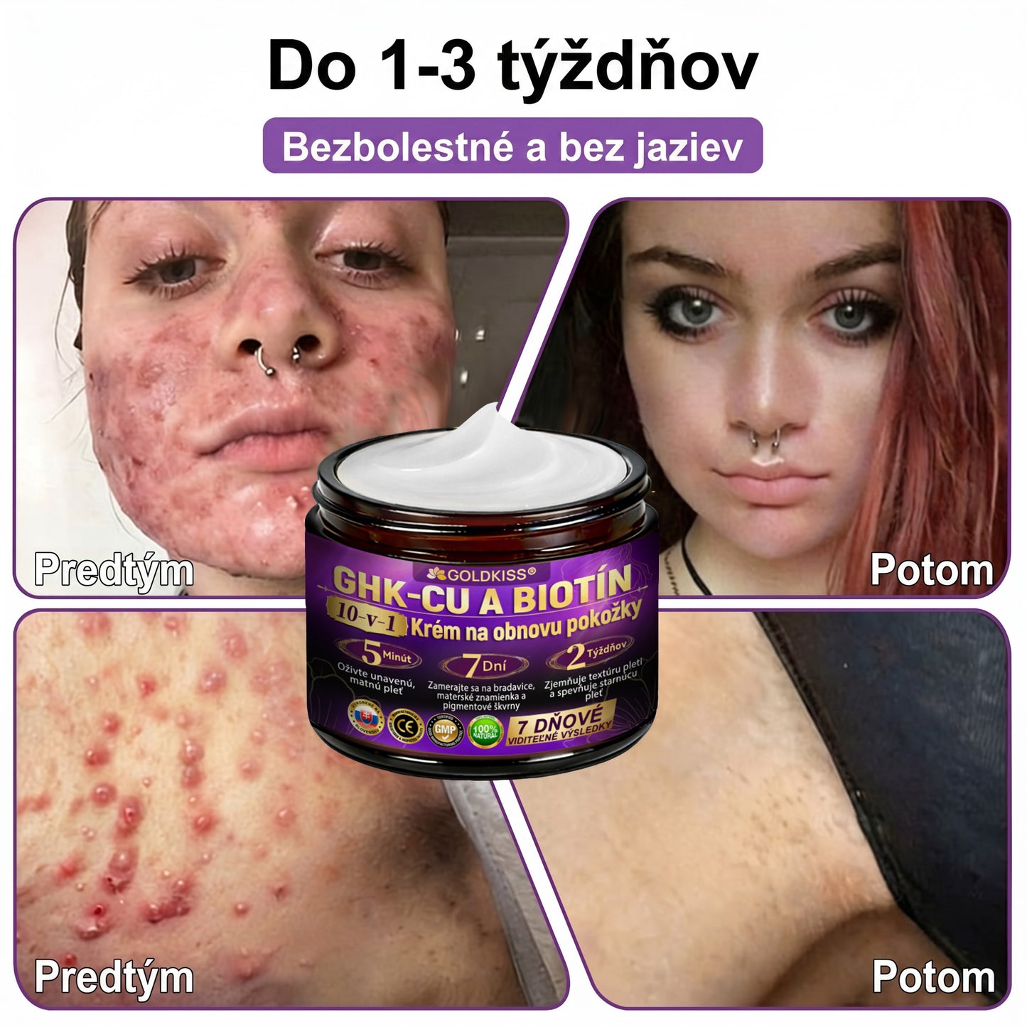 Vyrobené a odoslané zo Slovenska✨ 𝐆𝐎𝐋𝐃𝐊𝐈𝐒𝐒® 𝐆𝐇𝐊-𝐂𝐮 & 𝐁𝐈𝐎𝐓𝐈𝐍 𝟏𝟎-𝐈𝐍-𝟏 Krém na obnovenie pleti ⚡