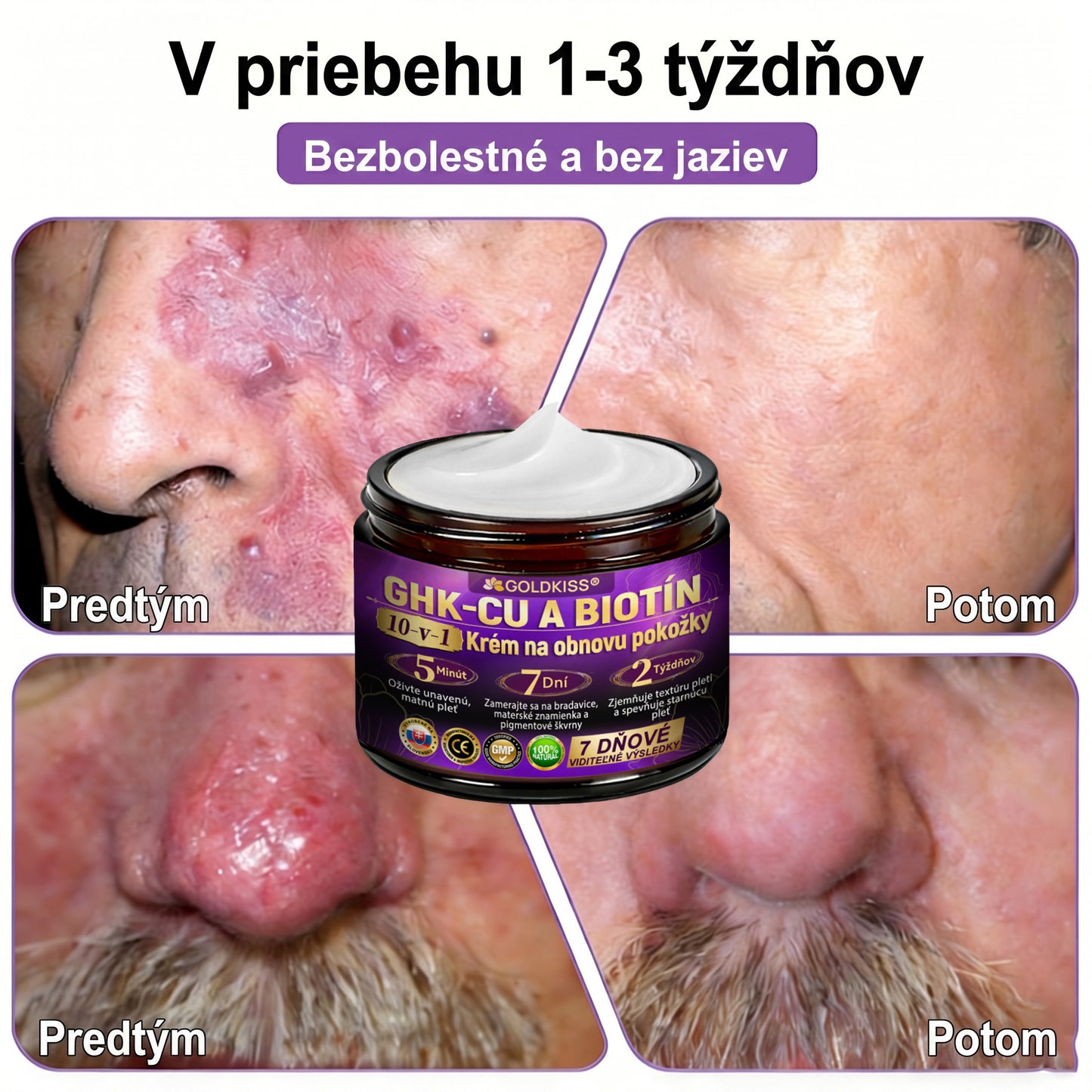 Vyrobené a odoslané zo Slovenska✨ 𝐆𝐎𝐋𝐃𝐊𝐈𝐒𝐒® 𝐆𝐇𝐊-𝐂𝐮 & 𝐁𝐈𝐎𝐓𝐈𝐍 𝟏𝟎-𝐈𝐍-𝟏 Krém na obnovenie pleti ⚡