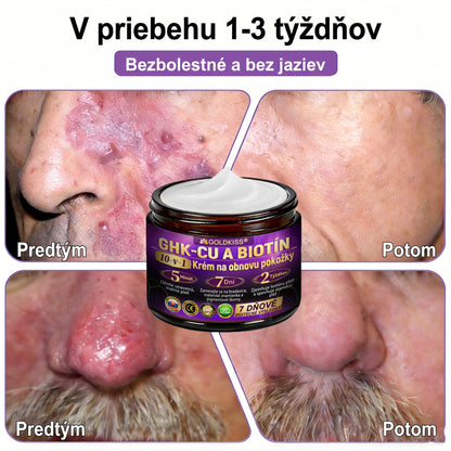 Vyrobené a odoslané zo Slovenska✨ 𝐆𝐎𝐋𝐃𝐊𝐈𝐒𝐒® 𝐆𝐇𝐊-𝐂𝐮 & 𝐁𝐈𝐎𝐓𝐈𝐍 𝟏𝟎-𝐈𝐍-𝟏 Krém na obnovenie pleti ⚡