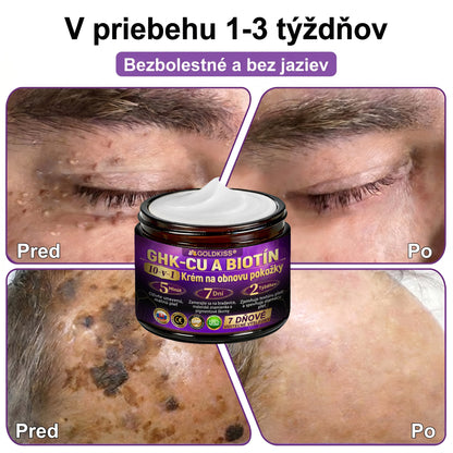 Vyrobené a odoslané zo Slovenska✨ 𝐆𝐎𝐋𝐃𝐊𝐈𝐒𝐒® 𝐆𝐇𝐊-𝐂𝐮 & 𝐁𝐈𝐎𝐓𝐈𝐍 𝟏𝟎-𝐈𝐍-𝟏 Krém na obnovenie pleti ⚡