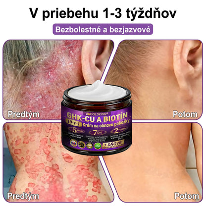 Vyrobené a odoslané zo Slovenska✨ 𝐆𝐎𝐋𝐃𝐊𝐈𝐒𝐒® 𝐆𝐇𝐊-𝐂𝐮 & 𝐁𝐈𝐎𝐓𝐈𝐍 𝟏𝟎-𝐈𝐍-𝟏 Krém na obnovenie pleti ⚡